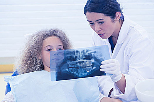 牙医,展示,x射线,牙齿,牙科诊所