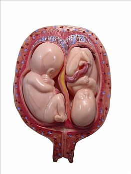 双胞胎,胚胎