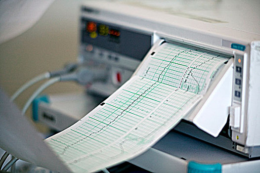 心脏监护器,机器,33岁,女人,出生,医院,魁北克,加拿大