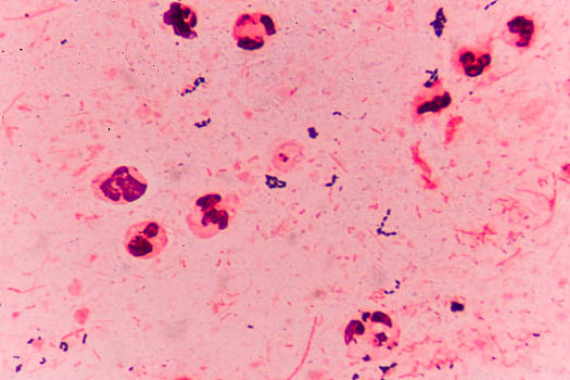 链球菌革兰氏染色图片