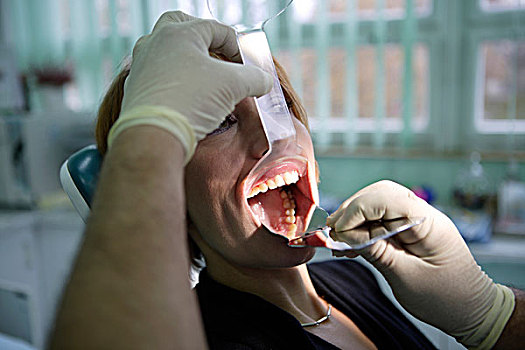 女人,39岁,牙科检查,牙科手术