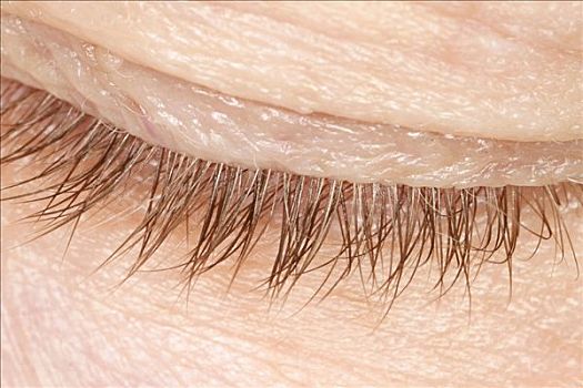 眼皮图片_眼皮图片大全_眼皮图片下载