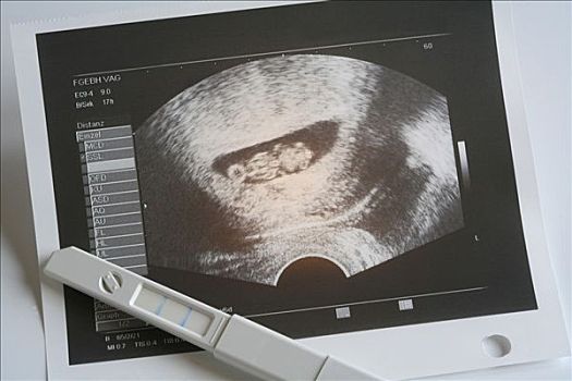 妊娠测试,结果,胎儿,星期,怀孕