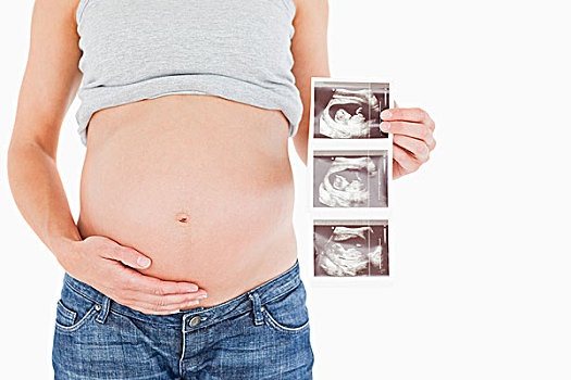 孕妇,展示,超声波扫描,站立