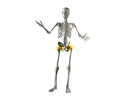 x光,人体骨骼,臀部,关节