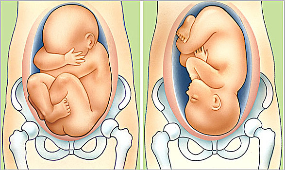 胎儿,腹部,母亲