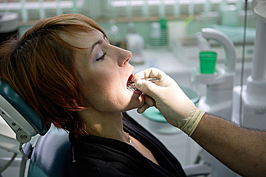 女人,39岁,牙科检查,牙科手术,牙齿,印记,牙套