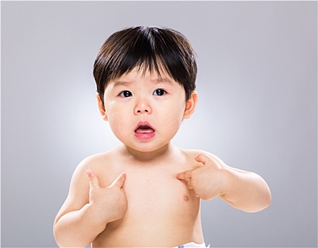 嬰兒,皮膚,問題