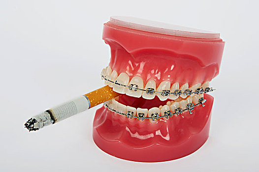 象征,青少年,吸烟,假牙,固定,牙套,香烟