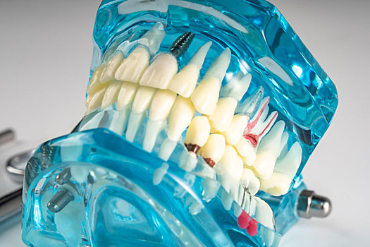 牙科医疗用具