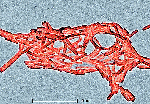 电子显微图,细菌