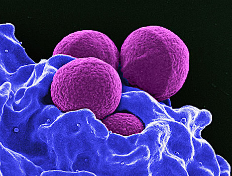 彩色,四个,球体,金黃色葡萄球菌,细菌,紫色,人,白细胞,蓝色