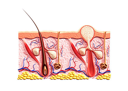 横断面,皮,展示,建筑,健康,毛发,腺,痤疮,丘疹,白色,医疗,插画,隔绝,白色背景,背景
