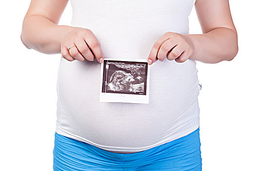怀孕,女人,腹部,超声波,图像