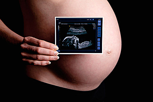 孕妇,拿着,超声波,正面,裸露,腹部