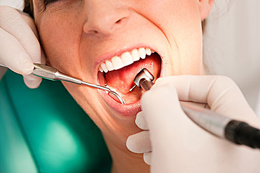 女病人,牙医,牙齿治疗,聚焦,电钻