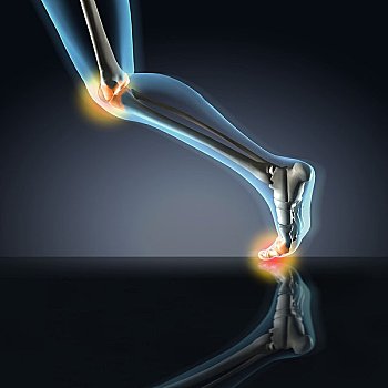 x光,腿,展示,痛苦,膝,踝部,脚,位置