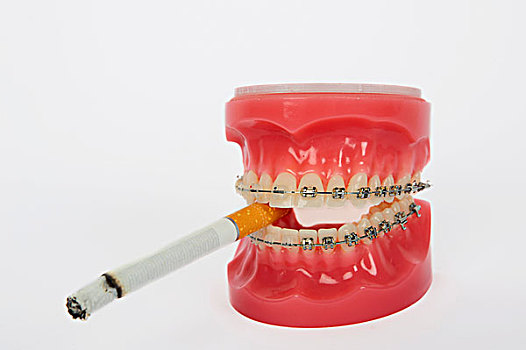 象征,青少年,吸烟,假牙,固定,牙套,香烟