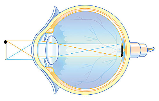 亮光,折射,眼部
