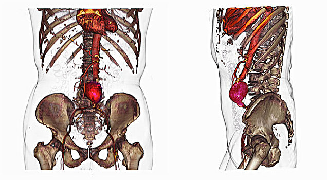 两个,ct扫描,扫瞄,图像,腹部