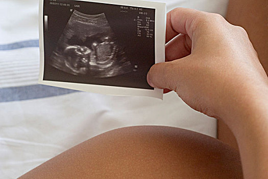 孕妇,拿着,超声波,局部