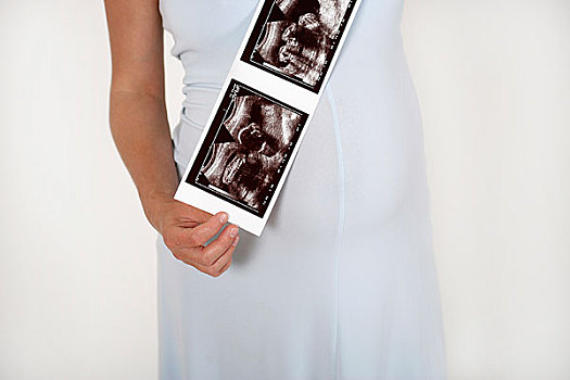 腹部,孕妇,拿着,超声波,图像