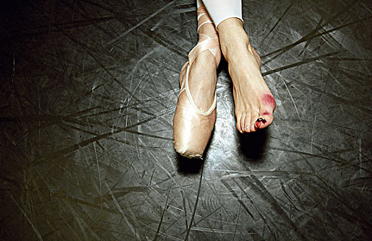 跳芭蕾舞的脚受损图片