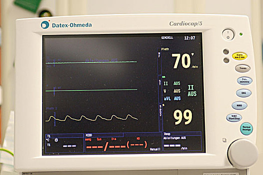 治疗,监控,比率,心率