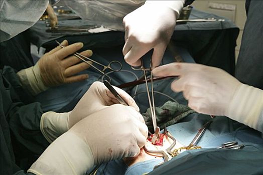 外科手术,缝缀,向上,动脉,大腿,德国