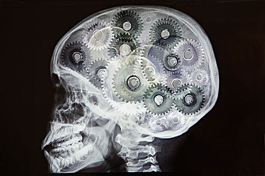 x光,头骨,齿轮,大脑,数码,蒙太奇
