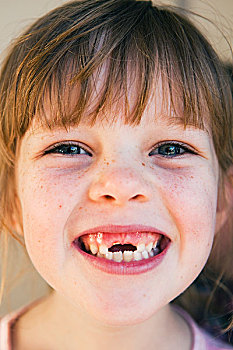 女孩,正面,牙齿,黄金海岸,昆士兰,澳大利亚