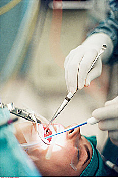 牙科手术