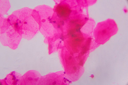 多,上皮细胞,显微镜,抽象,粉色,圆点,白色背景,背景