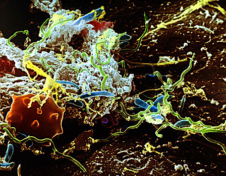 细菌,照亮,牙齿,包,扫描,电子显微镜,照片