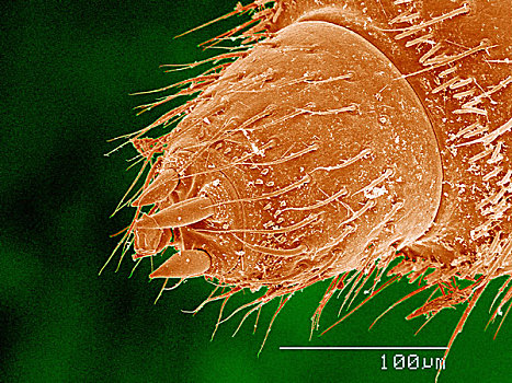 电子显微扫描图,雄性,千足虫