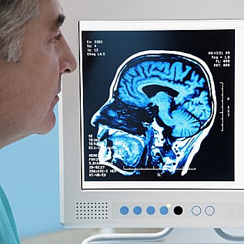 博士,检查,核磁共振成像,报告,大脑,电脑屏幕