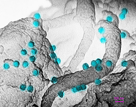 电子显微扫描图,病毒