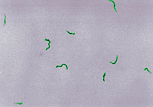 显微照片,细菌