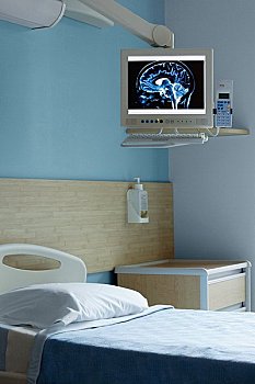 核磁共振扫描,大脑,电脑屏幕,病房