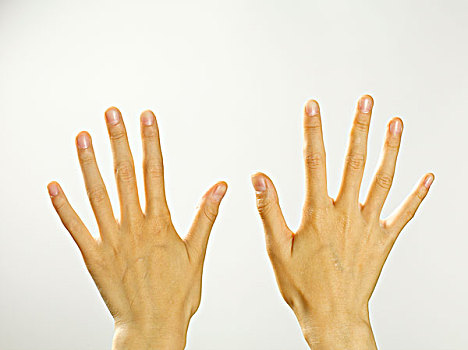 一双五指张开手背朝上的手
