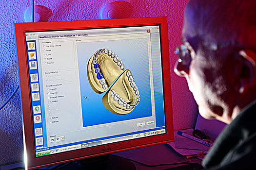 牙齿,实验室,制造,假肢,技工,电脑,设计,科技,建筑,桥,虚拟,模型,扫描,工作