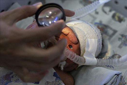 视力检查,早产,婴儿,重病护理,累西腓,巴西