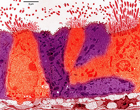 传送,电子,显微照片,上皮细胞