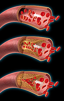 动脉,红血球