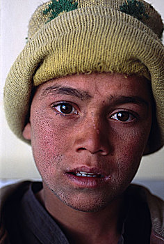 男孩,医疗,协助,健康,中心,地区,靠近,喀布尔,阿富汗