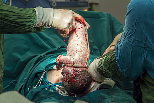 妇科手术图片