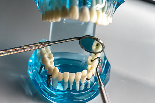 牙科医疗器械
