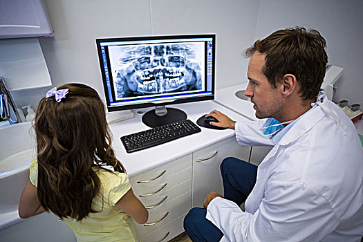 牙医,展示,x光,电脑,孩子,病人,牙科诊所
