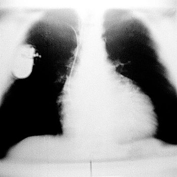 肺,x光片,起搏器,身体部位,博物馆,巴黎,法国