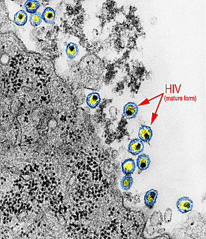 人,病毒,艾滋病毒